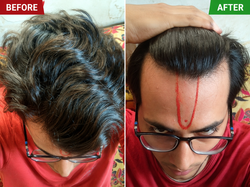 Before & After Result 1