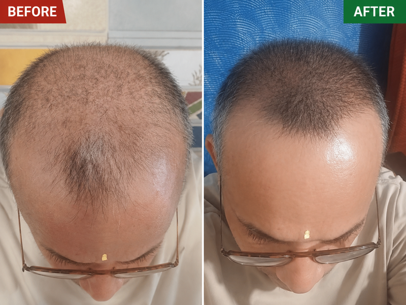 Before & After Result 2