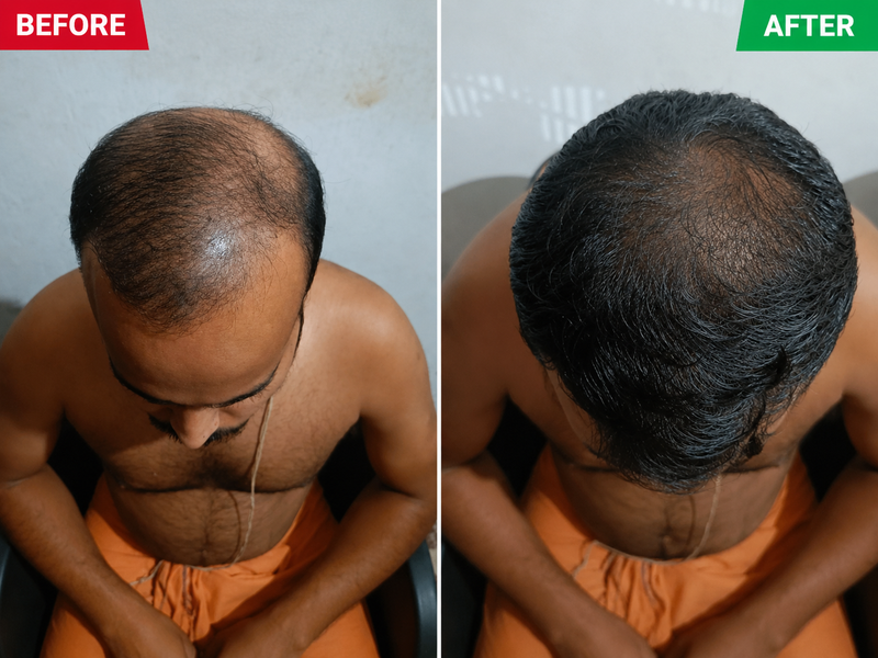 Before & After Result 3